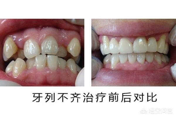 永康最新24小时牙医在线咨询方法分析(最方便真实的永康有没有24小时牙医方法)