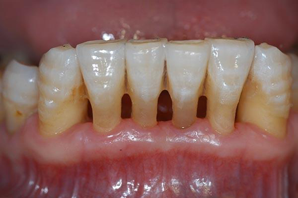 永康最新24小时牙医在线咨询方法分析(最方便真实的永康有没有24小时牙医方法)